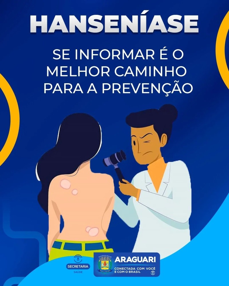 Hanseníase: se informar é o melhor caminho para prevenção